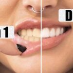 Bělení zubů doma: Jaké máme možnosti?